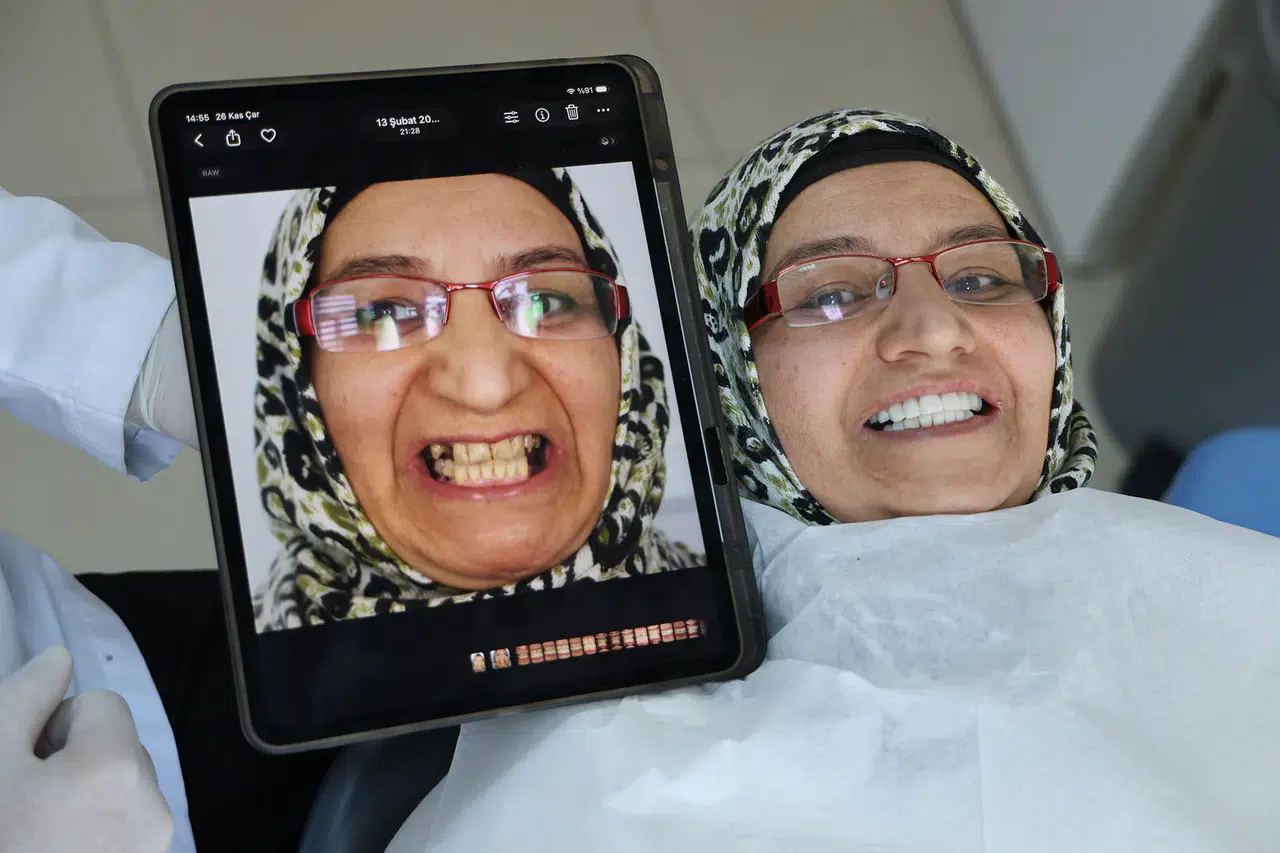 Deprem İlhamı: İmplantsız Yeni Diş Tedavisi Türkiye'de!