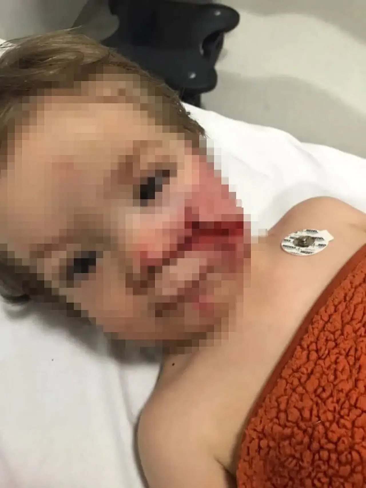 Pitbull Dehşeti: İki Kardeş Yaralandı