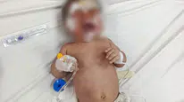 Şanlıurfa'da gizemli yangın! 14 kişilik aile komşuya sığındı, bebek yanarak yaralandı