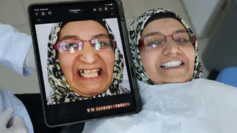 Deprem İlhamı: İmplantsız Yeni Diş Tedavisi Türkiye'de!