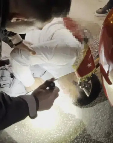 Palalı Saldırı: 1 Kişi Ağır Yaralandı