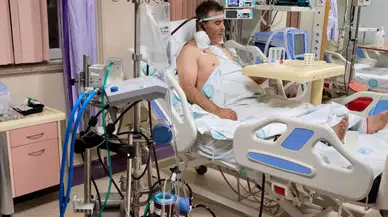 ECMO Cihazı ile Nadir Sendrom Tedavisi:  Sivas'ta Bir İlk!