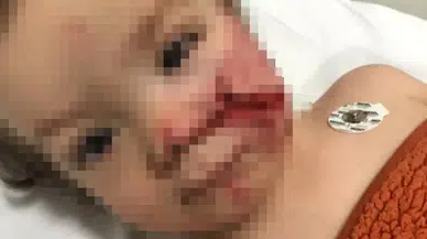 Pitbull Dehşeti: İki Kardeş Yaralandı