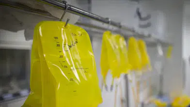 "Sarı Serum" Tehlikesi: Acil Tıp Uzmanı Uyardı! Ölüme Yol Açabilir