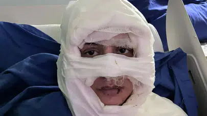 Akıl almaz olay: Genç kadın başka bir kadın tarafından ateşe verildi