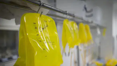 "Sarı Serum" Tehlikesi: Acil Tıp Uzmanı Uyardı! Ölüme Yol Açabilir