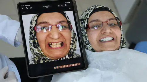 Deprem İlhamı: İmplantsız Yeni Diş Tedavisi Türkiye'de!