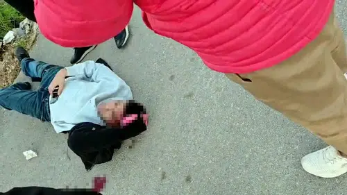 Tartışma kanla bitti! başından ve bacağından bıçaklandı