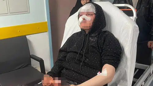 Gaziantep’te korkunç şiddet! Boşanmak isteyen karısını öldüresiye darp etti