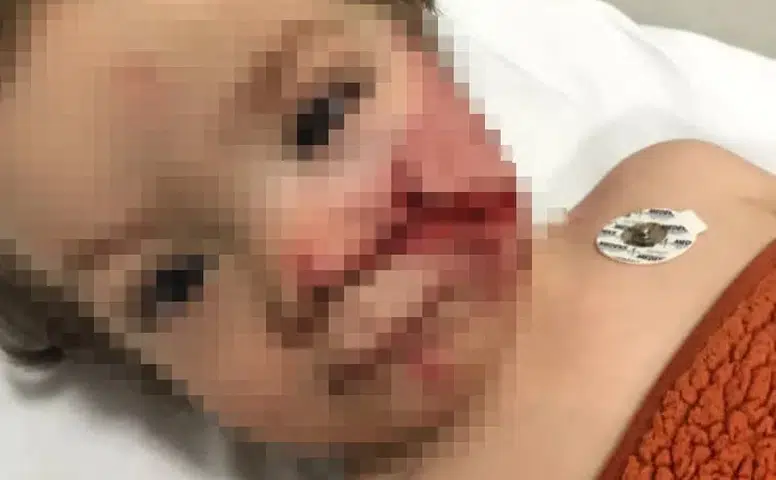 Pitbull Dehşeti: İki Kardeş Yaralandı