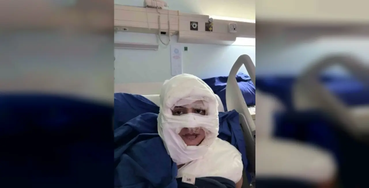 Akıl almaz olay: Genç kadın başka bir kadın tarafından ateşe verildi 1