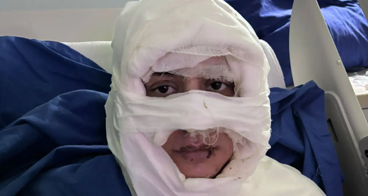 Akıl almaz olay: Genç kadın başka bir kadın tarafından ateşe verildi 2