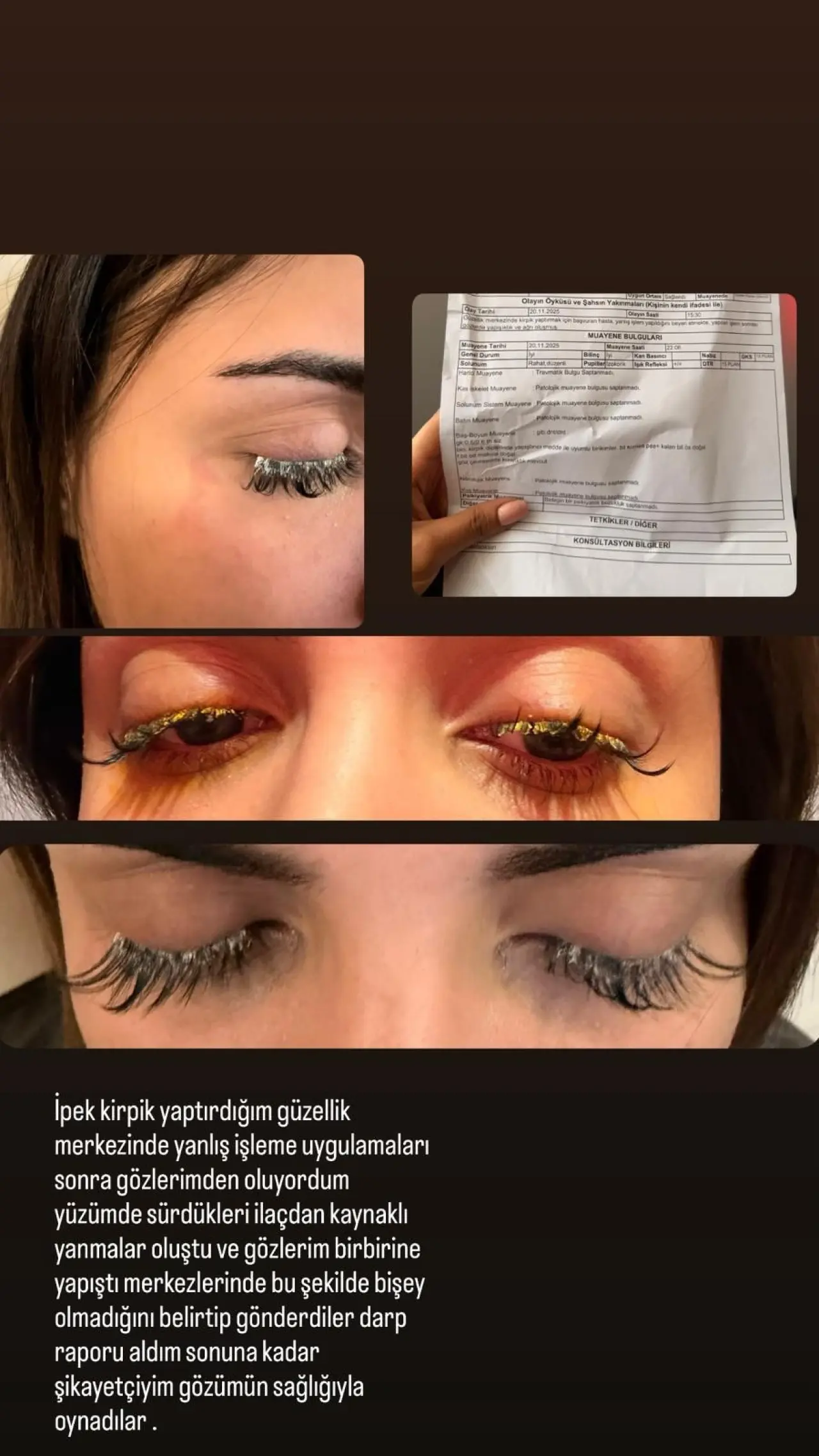 Güzellik merkezindeki işlem genç kadını kâbusa sürükledi! Gözlerinden oluyordu 3