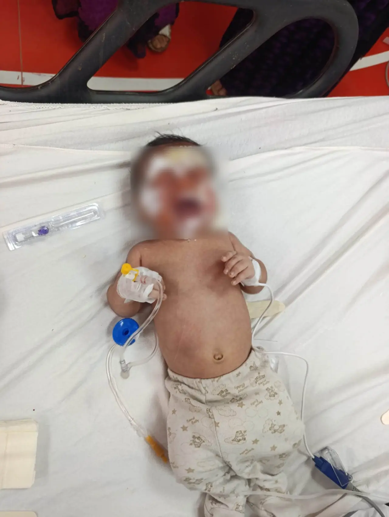 Şanlıurfa'da gizemli yangın! 14 kişilik aile komşuya sığındı, bebek yanarak yaralandı 2