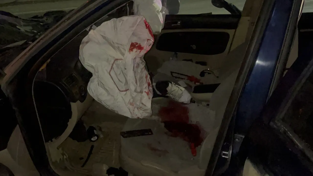 Bir anlık kontrol kaybı felakete döndü 3